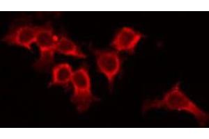 ABIN6266548 staining 293 by IF/ICC. (Metabotropic Glutamate Receptor 4 Antikörper  (C-Term))