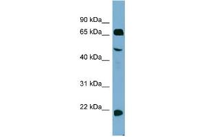WB Suggested Anti-ZNF746 Antibody Titration:  0. (ZNF746 Antikörper  (Middle Region))