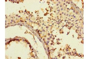 Immunohistochemistry of paraffin-embedded human testis tissue using ABIN7170749 at dilution of 1:100 (CYP17A1 Antikörper  (AA 1-508))