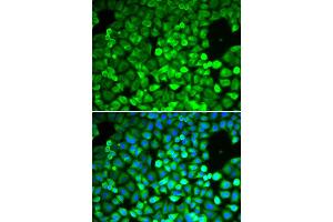 Immunofluorescence analysis of A549 cell using IPO5 antibody. (Importin 5 Antikörper  (AA 20-300))