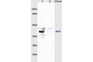 GPR15 Antikörper  (AA 51-150)