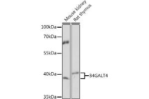 Western blot analysis of extracts of various cell lines, using B4G Rabbit pAb (ABIN7271201) at 1:1000 dilution. (B4GALT4 Antikörper  (AA 35-344))