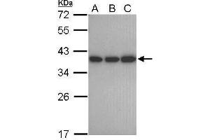 WB Image Sample (30 ug of whole cell lysate) A: 293T B: A431 C: Jurkat 12% SDS PAGE antibody diluted at 1:1000
