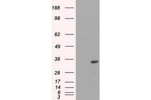 Image no. 3 for anti-DNA Fragmentation Factor, 45kDa, alpha Polypeptide (DFFA) antibody (ABIN1498772) (DFFA Antikörper)