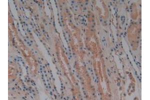 Detection of CFH in Human Kidney Tissue using Polyclonal Antibody to Complement Factor H (CFH)