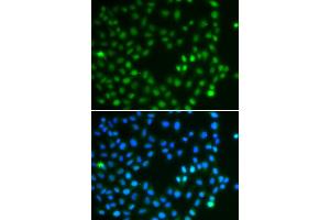 Immunofluorescence analysis of A549 cells using SALL4 antibody (ABIN5974283). (SALL4 Antikörper)