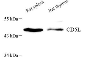 Western blot analysis of CD5L (ABIN7073398) at dilution of 1: 700 (CD5L Antikörper)