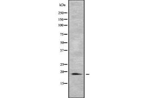 Western blot analysis of PTRH2 using COLO205 whole cell lysates
