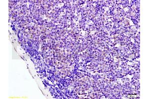 Formalin-fixed and paraffin embedded mouse colon labeled with Anti-AMPK alpha-1/PRKAA1 Polyclonal Antibody, Unconjugated (ABIN737886) at 1:200 followed by conjugation to the secondary antibody and DAB staining. (PRKAA1 Antikörper  (AA 351-450))