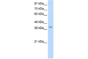 WB Suggested Anti-MYST4 Antibody Titration:  0.