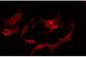 ABIN6275954 staining Hela by IF/ICC. (G Protein-Coupled Receptor 119 Antikörper  (Internal Region))