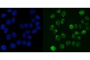 IF analysis of RCC1 using anti-RCC1 antibody (ABIN7600022).