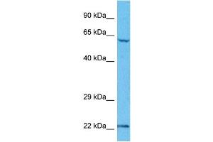 Host:  Rabbit  Target Name:  UBE2E2  Sample Tissue:  Human HepG2 Whole Cell  Antibody Dilution:  1ug/ml (UBE2E2 Antikörper  (N-Term))