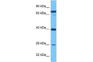 Host:  Rabbit  Target Name:  IGFBP4  Sample Tissue:  Human MDA-MB-435s Whole Cell  Antibody Dilution:  1ug/ml