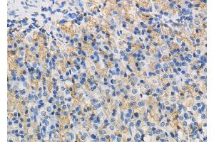 anti-WNK Lysine Deficient Protein Kinase 2 (WNK2) (Internal Region) antibody