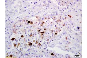 Immunohistochemistry (IHC) image for anti-Mannose Receptor, C Type 1 (MRC1) (AA 201-300) antibody (ABIN1386219)