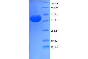 SDS-PAGE (SDS) image for Prefoldin Subunit 1 (PFDN1) (AA 2-122) protein (GST tag) (ABIN7479245)