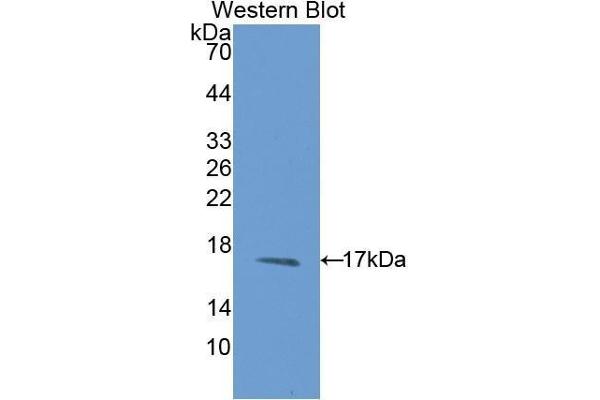 MSMB Antikörper  (AA 19-114)