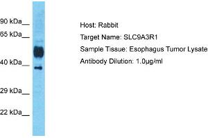 Host: Rabbit Target Name: SLC9A3R1 Sample Tissue: Human Esophagus Tumor Antibody Dilution: 1ug/ml