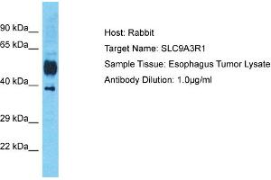 Host: Rabbit Target Name: SLC9A3R1 Sample Tissue: Human Esophagus Tumor Antibody Dilution: 1ug/ml (SLC9A3R1 Antikörper  (C-Term))