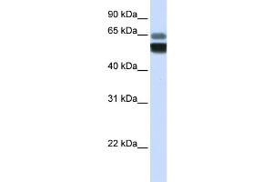 Western Blotting (WB) image for anti-Sphingomyelin phosphodiesterase 1, Acid Lysosomal (SMPD1) antibody (ABIN2458155)