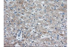 Immunohistochemical staining of paraffin-embedded Human liver tissue using anti-IGF2BP2 mouse monoclonal antibody.