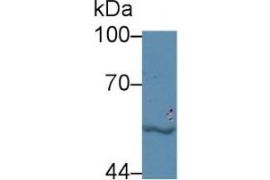 Detection of LBP in Human Jurkat cell lysate using Polyclonal Antibody to Lipopolysaccharide Binding Protein (LBP) (LBP Antikörper  (AA 224-468))