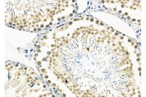 ABIN6265535 and ABIN6266529 at 1/100 staining Rat testis tissue by IHC-P. (DP1 Antikörper  (C-Term))