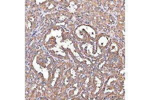 IHC analysis of TTLL2 using anti-TTLL2 antibody (ABIN7600850).