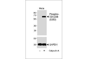 Western blot analysis of lysates from Hela cell line, untreated or treated with 20 % FBS + 100nM Calyculin A, 15 min, using Phospho-CDC25B Antibody (upper) or GDH(lower). (CDC25B Antikörper  (pSer353))