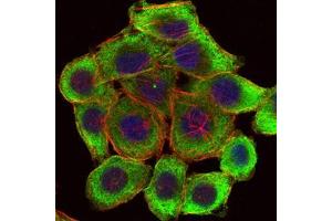Immunofluorescence (IF) image for anti-LIM and Senescent Cell Antigen-Like Domains 1 (LIMS1) antibody (ABIN969354)