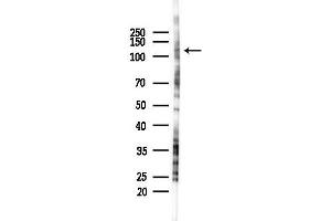 anti-SR-Related CTD-Associated Factor 1 (SCAF1) (N-Term) antibody