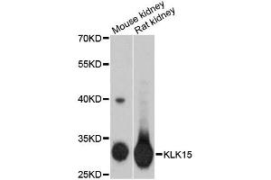 Western blot analysis of extracts of various cell lines, using KLK15 antibody (ABIN1873439) at 1:3000 dilution. (Kallikrein 15 Antikörper)
