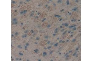 IHC-P analysis of Rat Tissue, with DAB staining. (Insulin Receptor Antikörper  (AA 1114-1382))