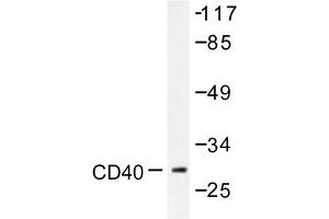 Image no. 1 for anti-CD40 (CD40) antibody (ABIN271944) (CD40 Antikörper)