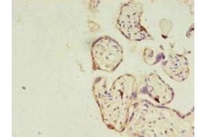 Immunohistochemistry (IHC) image for anti-RAS-Like, Estrogen-Regulated, Growth Inhibitor (RERG) (AA 1-199) antibody (ABIN7167192)