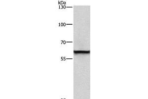 Western Blot analysis of A431 cell using TRIP4 Polyclonal Antibody at dilution of 1:400 (TRIP4 Antikörper)