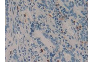 Immunohistochemistry (IHC) image for anti-Laminin, gamma 2 (LAMC2) (AA 416-602) antibody (ABIN7442369)
