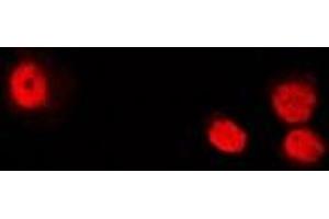 Immunofluorescent analysis of ATIC staining in U2OS cells. (ATIC Antikörper)