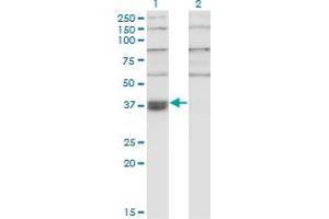 Western Blotting (WB) image for anti-THO Complex 6 Homolog (THOC6) (AA 71-180) antibody (ABIN566350)
