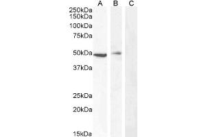 ABIN190840 (0. (Carabin Antikörper  (Internal Region))
