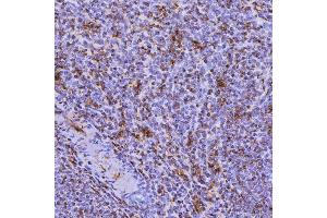 IHC analysis of SEPT6/SEPTIN6 using anti-SEPT6/SEPTIN6 antibody (ABIN7599390).