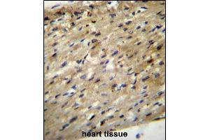ABCD2 Antibody (C-term) (ABIN656554 and ABIN2845816) immunohistochemistry analysis in formalin fixed and paraffin embedded human heart tissue followed by peroxidase conjugation of the secondary antibody and DAB staining.