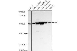 Western blot analysis of extracts of various cell lines, using ME1 antibody (ABIN1680809, ABIN3018339, ABIN3018340 and ABIN6220439) at 1:500 dilution. (ME1 Antikörper  (AA 1-300))