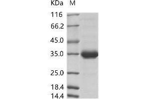 Western Blotting (WB) image for Zika Virus Membrane (ZIKV M) protein (Fc Tag) (ABIN7198755)