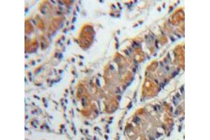 Used in DAB staining on fromalin fixed paraffin-embedded Stomach tissue (CXCL5 Antikörper  (AA 45-118))