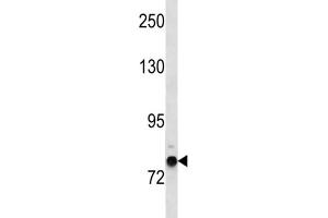 Western Blotting (WB) image for anti-Zinc Finger Protein 12 (ZNF12) antibody (ABIN3004528) (ZNF12 Antikörper)