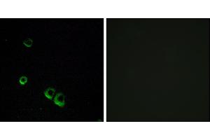 Immunofluorescence analysis of MCF-7 cells, using AVPR2 antibody. (AVPR2 Antikörper)