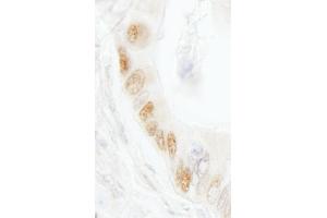 Immunohistochemistry (IHC) image for anti-Ligase I, DNA, ATP-Dependent (LIG1) (AA 200-250) antibody (ABIN7454389)