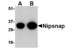 Image no. 1 for anti-4-Nitrophenylphosphatase Domain and Non-Neuronal SNAP25-Like Protein Homolog 1 (NIPSNAP1) (C-Term) antibody (ABIN1492169) (NIPSNAP1 Antikörper  (C-Term))